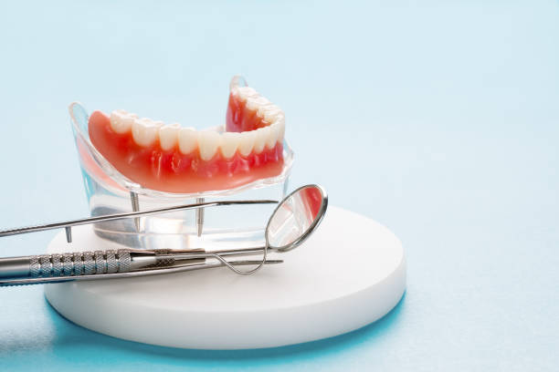 Dental Inlays and Onlays in Beulaville, NC